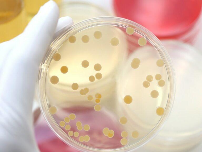 Hygieneinspektion: Probenansicht einer Petrischale mit Organismen